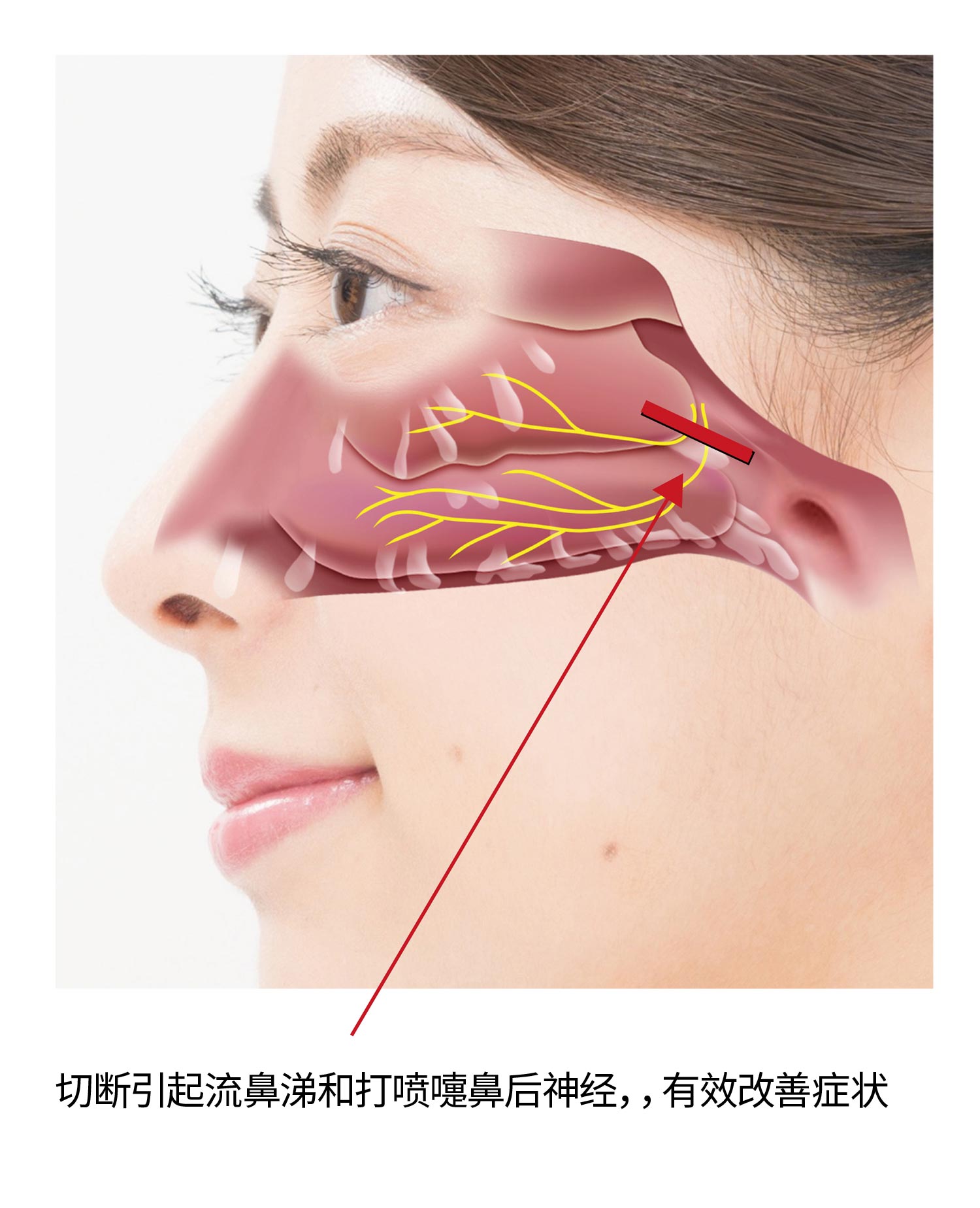 手术类型 适用 Sanka八幡西诊所 耳鼻喉科